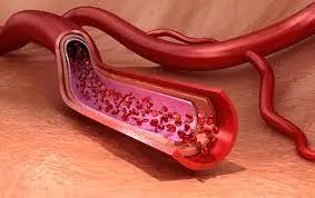 endothelial